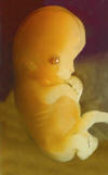 baby at seven weeks old respect life anti-abortion pic